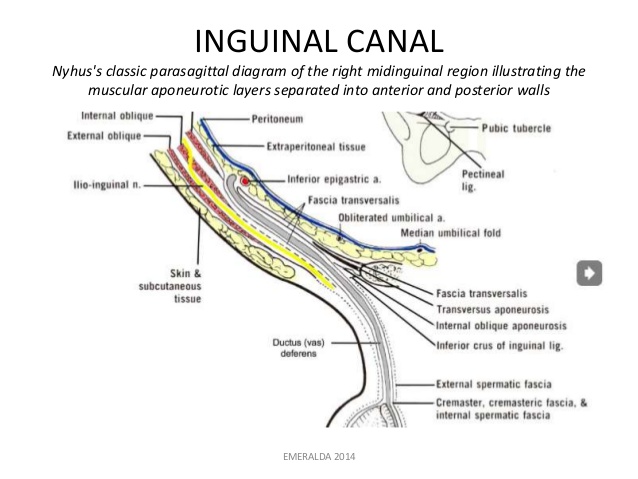 inguinal-hernia-17-638-1