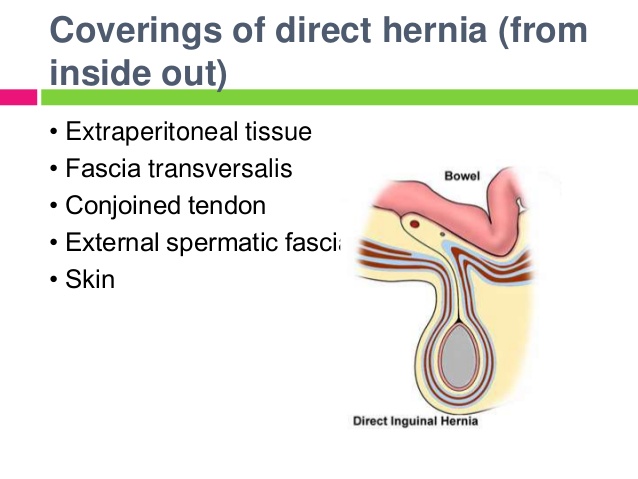 hernia-24-638